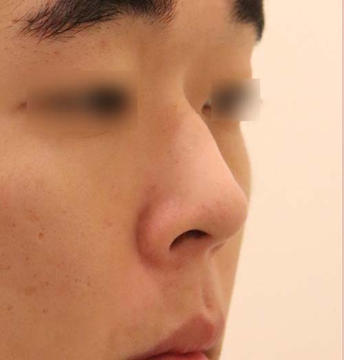 치료 전 이미지