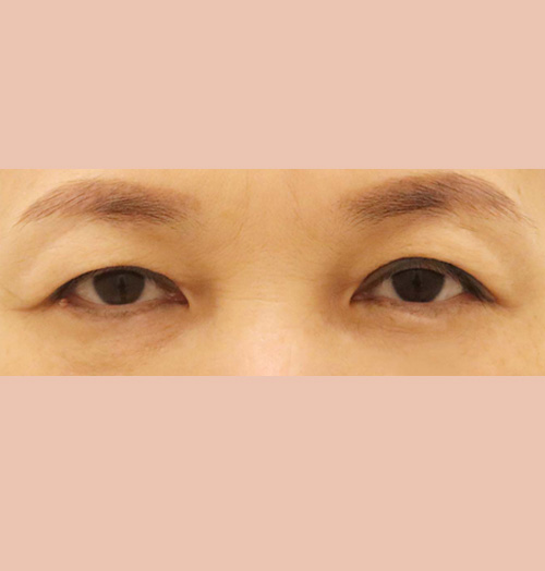 치료 전 이미지