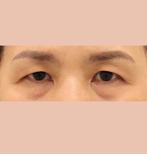 치료 전 이미지