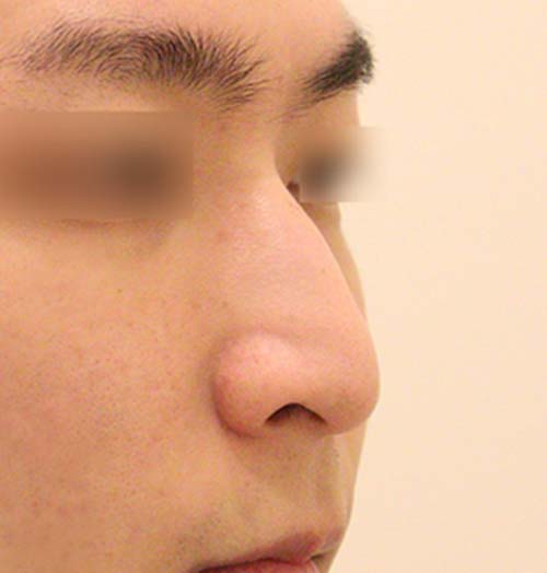 치료 전 이미지