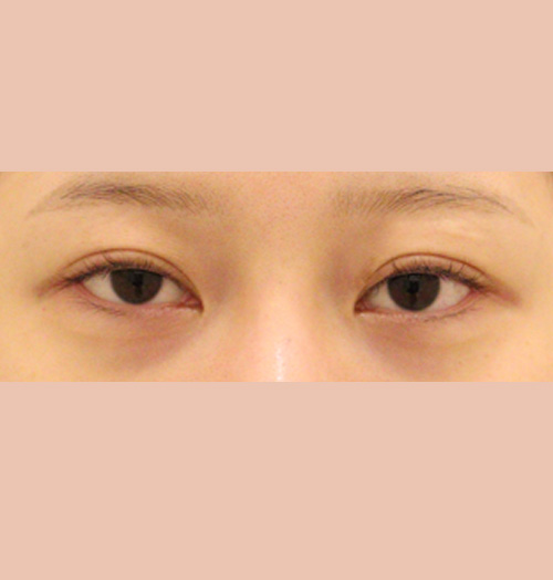 치료 전 이미지