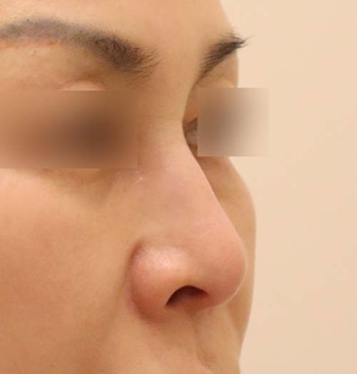 치료 전 이미지