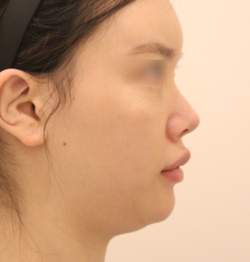 치료 전 이미지