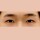 치료 후 이미지