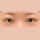 치료 후 이미지